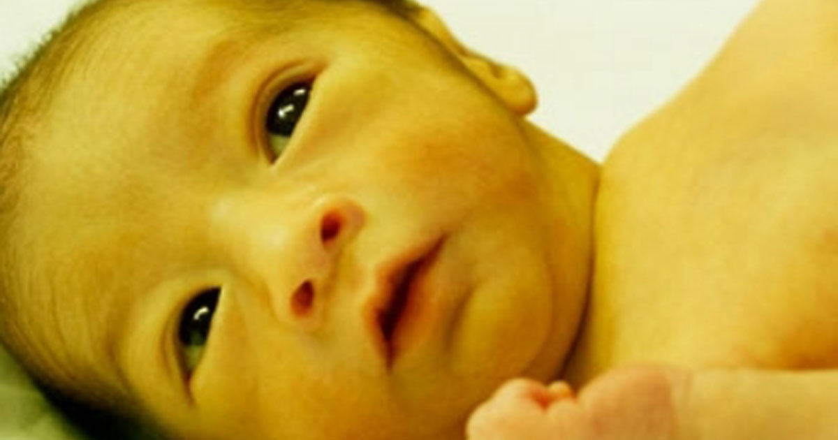 Can Babies Develop Jaundice After Birth?
