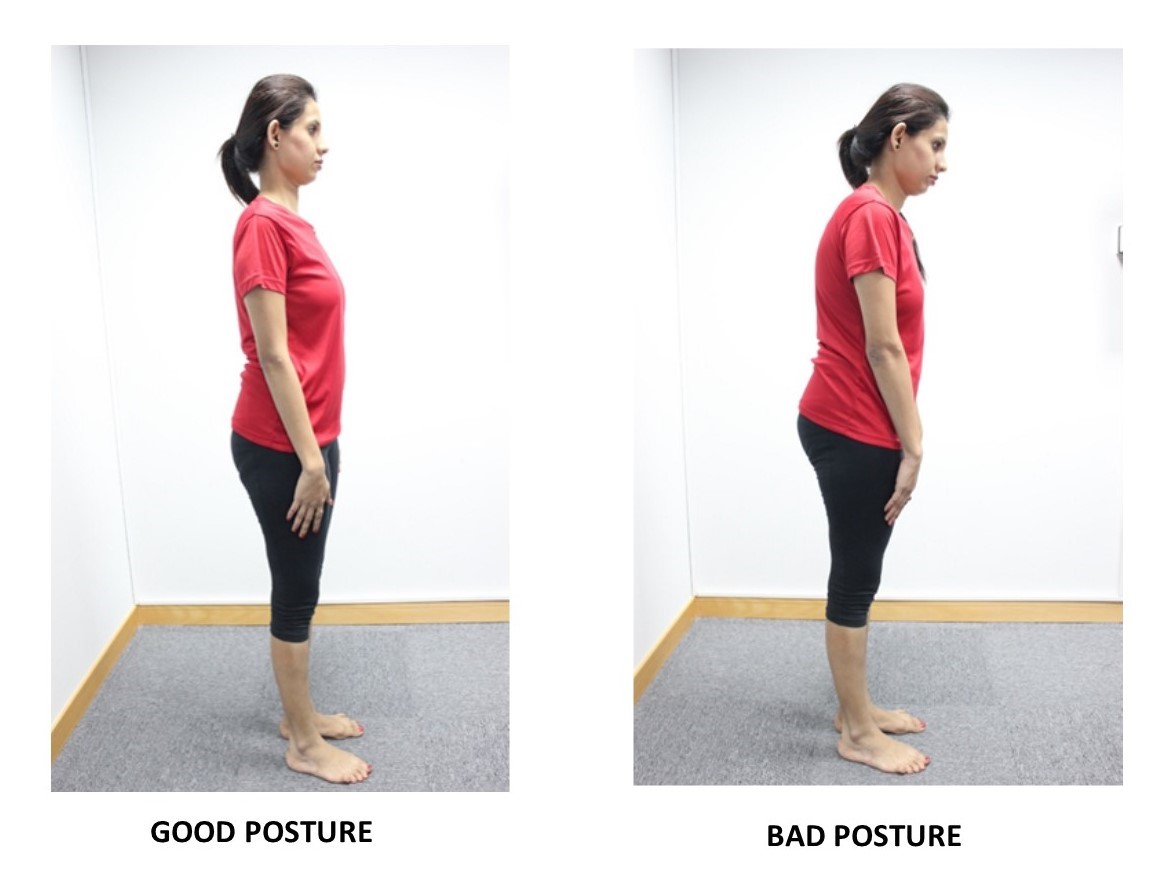 Common Areas of Pain from Poor Posture